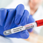 How Can I Tell If I Should Have Covid-19 Tested?