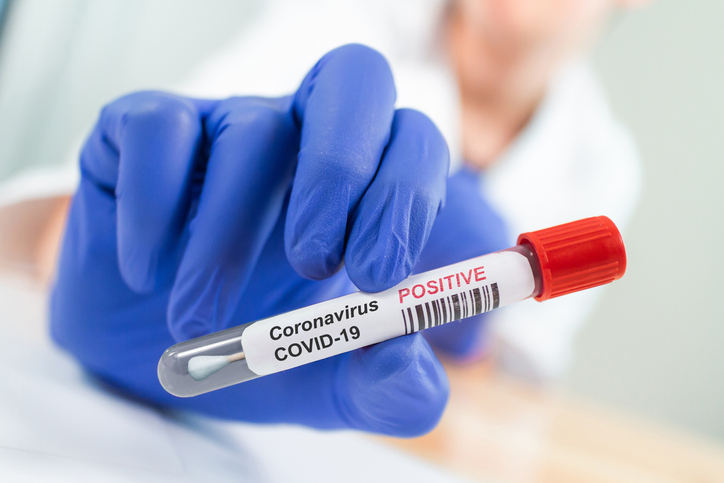 How Can I Tell If I Should Have Covid-19 Tested?